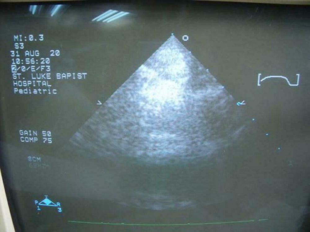
                  
                    Philips 21311A S3 Ultrasound Probe | PR5323
                  
                