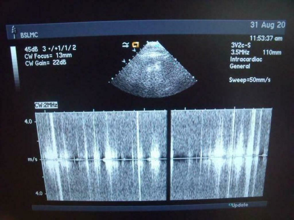 
                  
                    ACUSON 3V2C ULTRASOUND PROBE | PR5325
                  
                