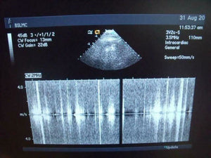 
                  
                    ACUSON 3V2C ULTRASOUND PROBE | PR5325
                  
                