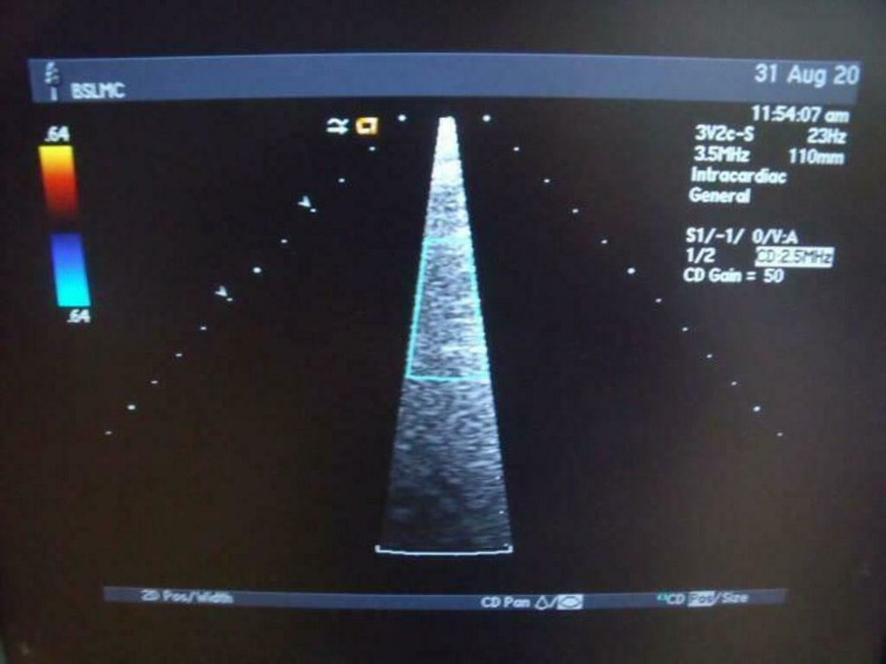 
                  
                    ACUSON 3V2C ULTRASOUND PROBE | PR5325
                  
                