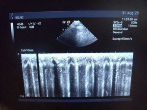 
                  
                    ACUSON 3V2C ULTRASOUND PROBE | PR5325
                  
                