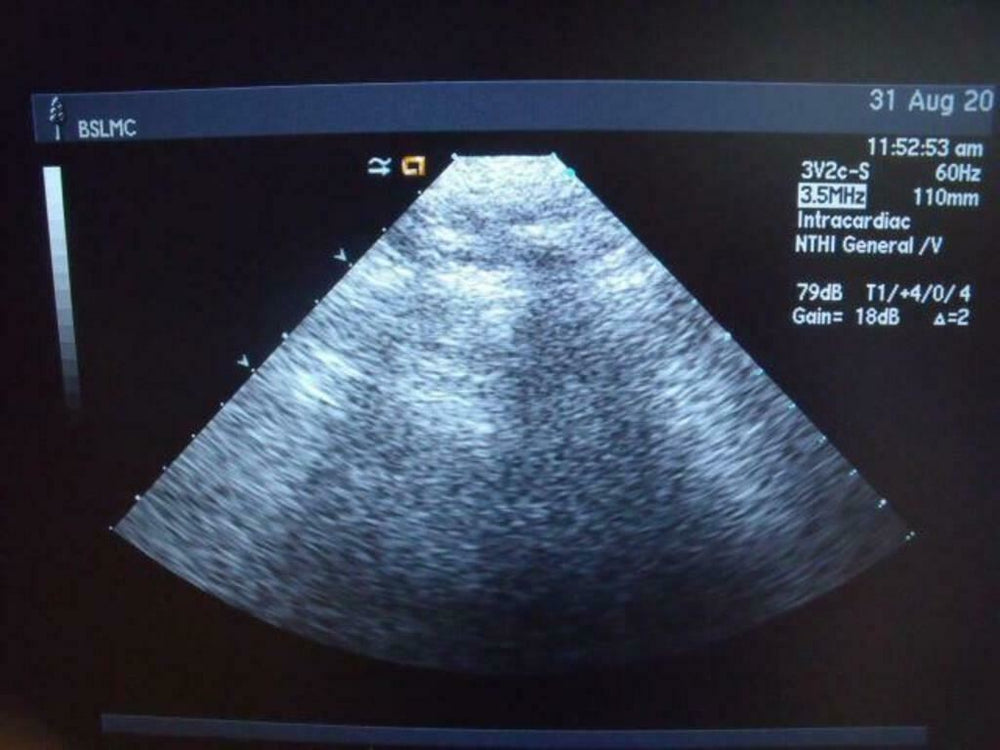
                  
                    ACUSON 3V2C ULTRASOUND PROBE | PR5325
                  
                