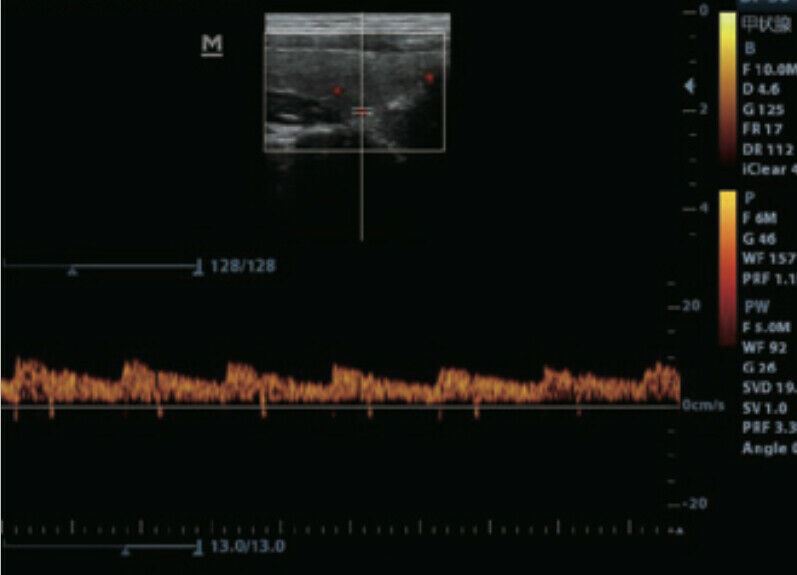 
                  
                    Affordable Color Doppler Ultrasound two probes Convex & Linear Array
                  
                