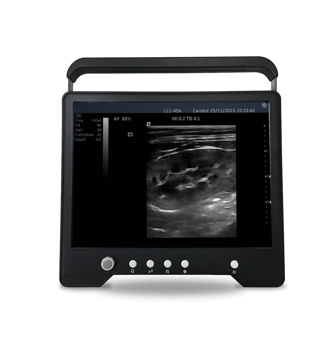 swine and sheep electronic probe pregnancy ultrasound scanner