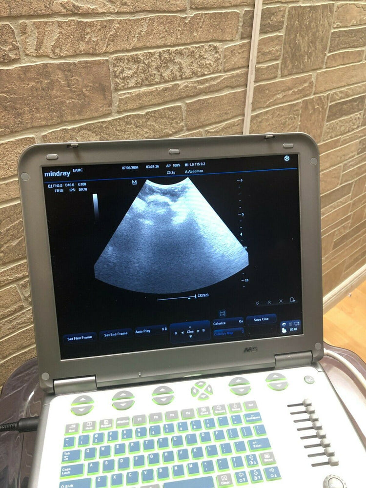 
                  
                    MINDRAY M5 Ultrasound Vascular MSK with linear array probe
                  
                