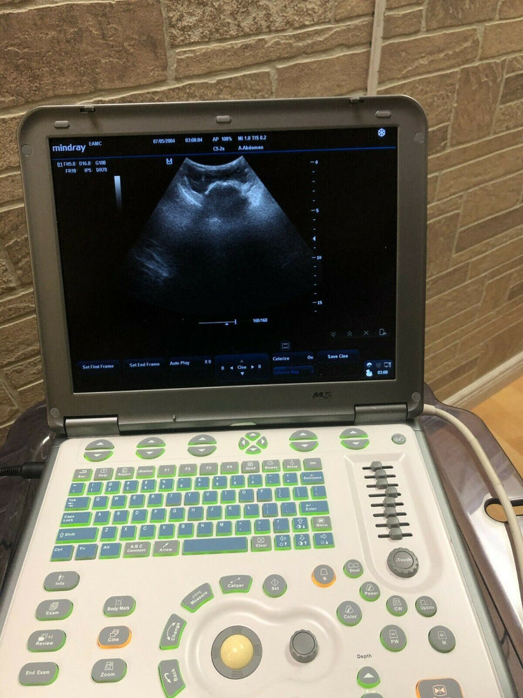 
                  
                    MINDRAY M5 Ultrasound Vascular MSK with linear array probe
                  
                