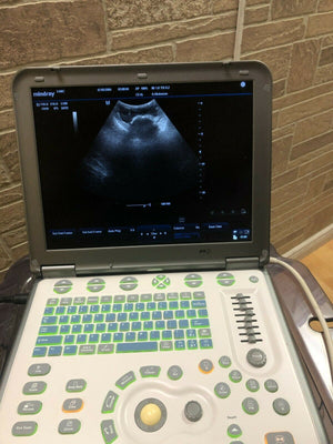 
                  
                    MINDRAY M5 Ultrasound Vascular MSK with linear array probe
                  
                
