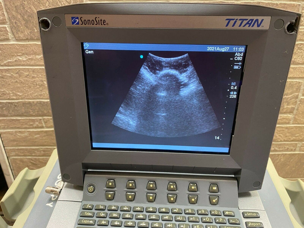 
                  
                    SONOSITE TITAN PORTABLE ULTRASOUND MACHINE WITH 1 PROBE (C60)
                  
                