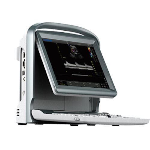 
                  
                    Color Doppler Chison Ultrasound & Linear Probe, Trolley, Battery, PW Vascular
                  
                