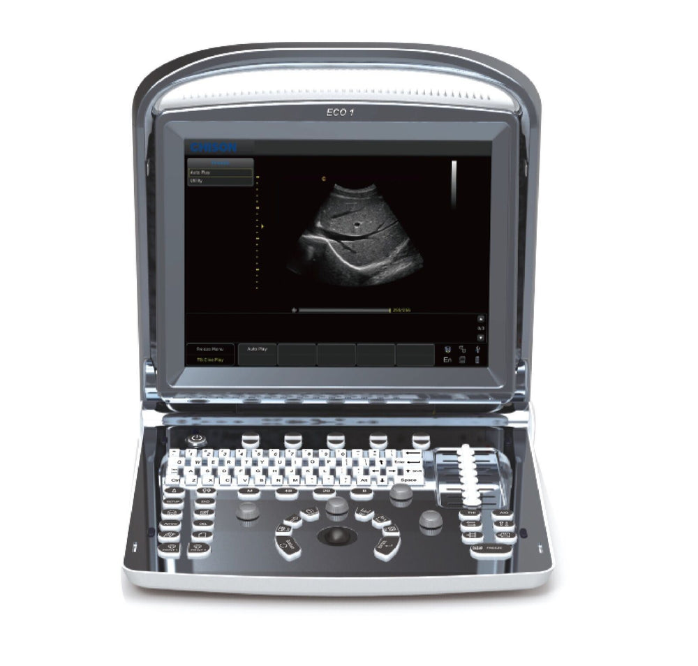 
                  
                    Con Batería Bovino, Equino, Veterinario Portátil Ultrasonidos Máquina, ECO1Vet
                  
                