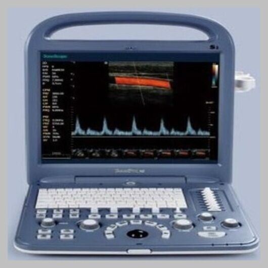 
                  
                    SonoScape S2 with Linear Array Probe for MSK, Vascular Ultrasound
                  
                