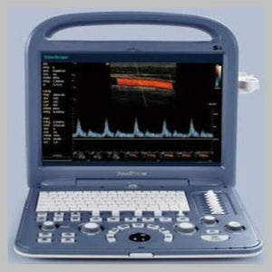 
                  
                    SonoScape S2 with Linear Array Probe for MSK, Vascular Ultrasound
                  
                