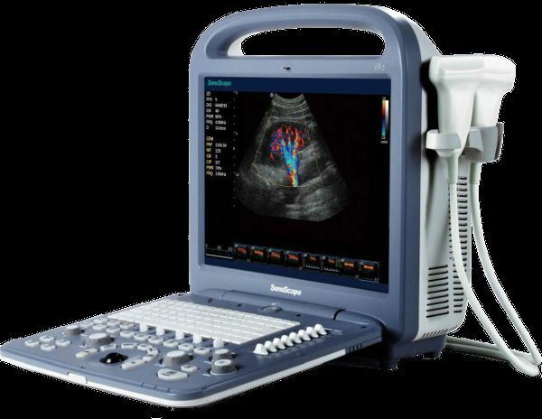 
                  
                    SonoScape S2 with Linear Array Probe for MSK, Vascular Ultrasound
                  
                