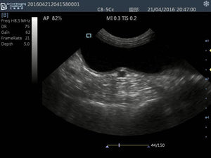 
                  
                    Quality DP30 Veterinary Ultrasound 12" Screen & Rectal Probe, 50L60EAV
                  
                
