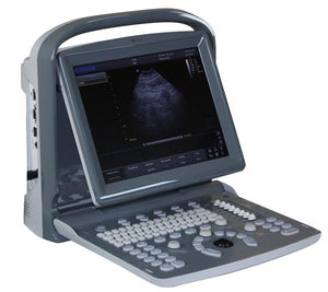 
                  
                    Chison ECO1 Portable LED Ultrasound Scanner, Quality and Affordable
                  
                