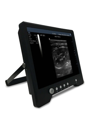 
                  
                    Veterinario Touchscreen Ultrasound&micro-convex Sonda per S Animali, Keebomed
                  
                