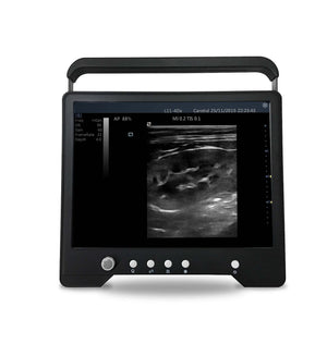 
                  
                    Veterinario Touchscreen Ultrasound&micro-convex Sonda per S Animali, Keebomed
                  
                
