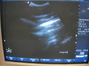 
                  
                    PHILIPS HD11 Ultrasound Machine with convex probe C-3 in Good condition
                  
                