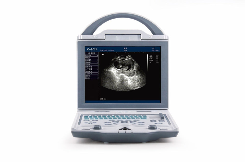 Newest-Light Weight Portable Ultrasound & One Probe, DICOM, LED screen