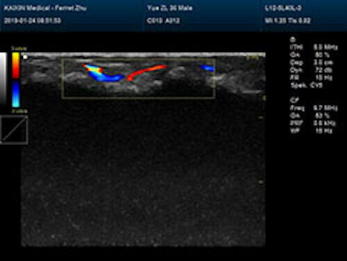 
                  
                    Newest- Farbe Tragbar Ultraschall & Ein Sonde, Dicom , LED Display
                  
                
