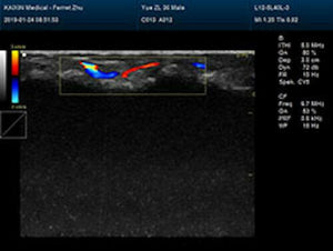 
                  
                    Newest- Farbe Tragbar Ultraschall & Ein Sonde, Dicom , LED Display
                  
                