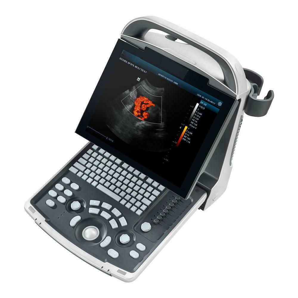 Erschwingliche Farbe Doppler Ultraschall Zwei Sonden Konvex & Lineare Anordnung