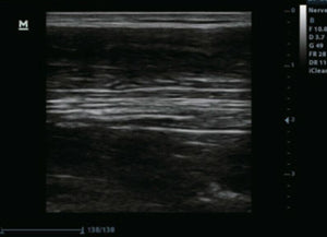 
                  
                    Erschwingliche Farbe Doppler Ultraschall Zwei Sonden Konvex & Lineare Anordnung
                  
                