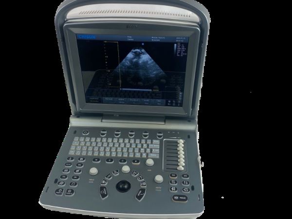 Chison ECO6 Portable  Color doppler Ultrasound with CW and phase array probe P3E