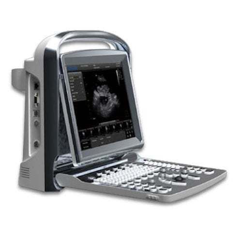 
                  
                    Chison ECO1 Portable LED Ultrasound Scanner with Printer, Quality and Affordable
                  
                