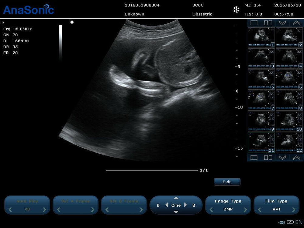 
                  
                    Ultrasound Color Doppler, Quality Continuous Wave CW & Two Probes, C7
                  
                