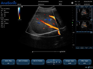 
                  
                    Ultrasound Color Doppler, Quality Continuous Wave CW & Two Probes, C7
                  
                