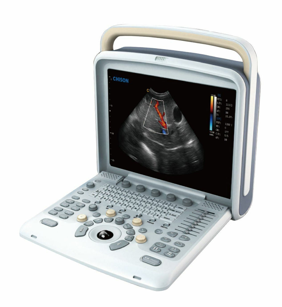 
                  
                    Veterinary Ultrasound Scanner with 2 Probes - Color Doppler Chison Q5Vet
                  
                