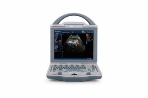 
                  
                    Asequible Color Doppler Ultrasonidos con Lineal Medidor, Multi Idiomas & Pw Modo
                  
                