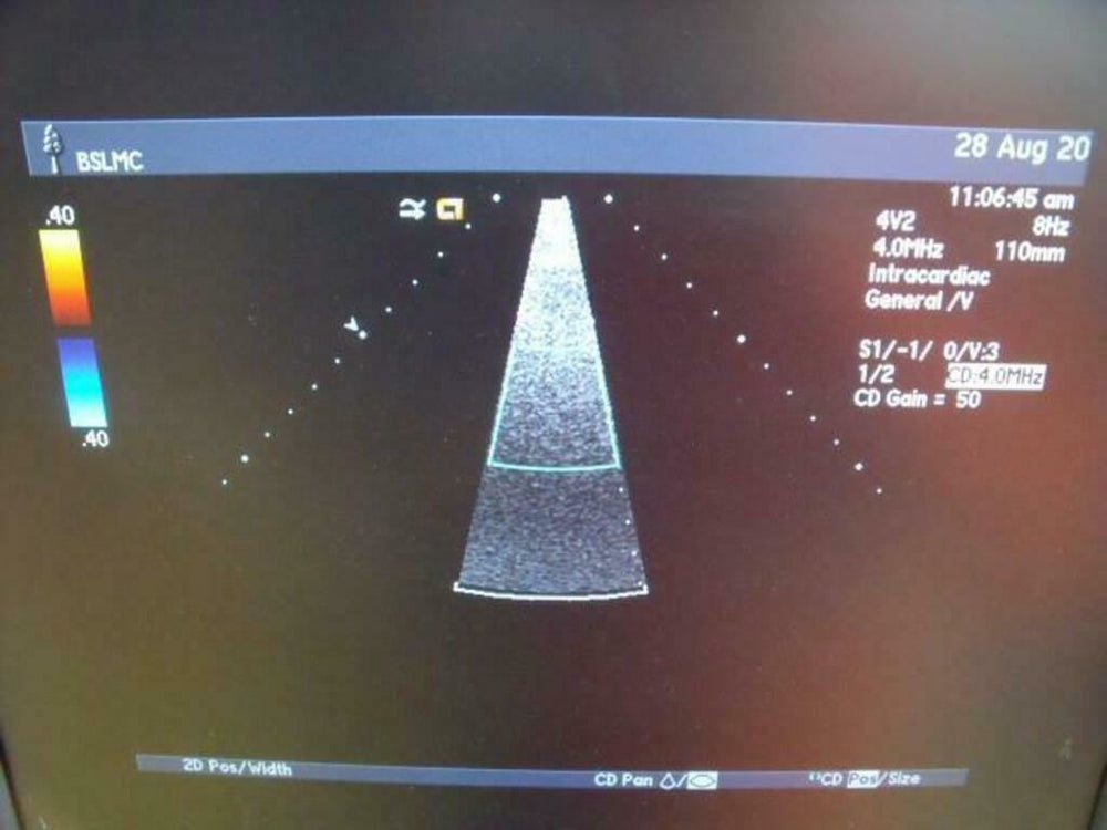 
                  
                    ACUSON 47446-93742503 4V2 ULTRASOUND PROBE | PR5320
                  
                
