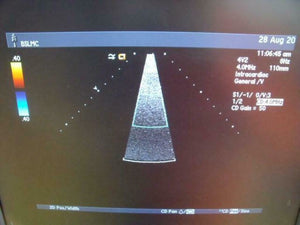 
                  
                    ACUSON 47446-93742503 4V2 ULTRASOUND PROBE | PR5320
                  
                