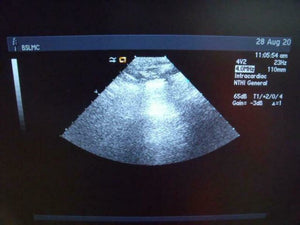 
                  
                    ACUSON 47446-93742503 4V2 ULTRASOUND PROBE | PR5320
                  
                
