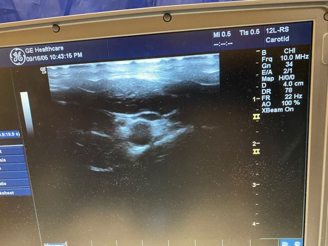 
                  
                    GE LOGIQ E Portable Ultrasound & phased array cardiac probe 3S-RS-Refurbished
                  
                