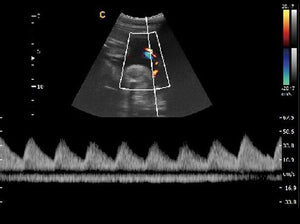 
                  
                    Chison Q5 Color Doppler Ultrasound Scanner With one linear array probe
                  
                