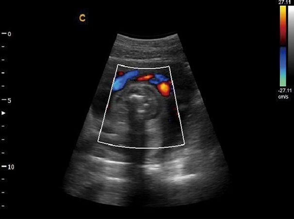 
                  
                    Chison Q5 Color Doppler Ultrasound Scanner With one linear array probe
                  
                