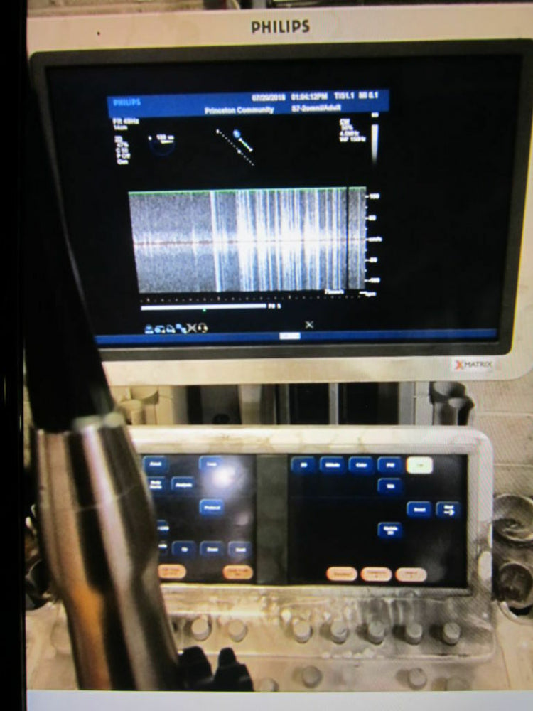 
                  
                    PHILIPS S7-2 Omni Ultrasound Transducer Probe (54DM)
                  
                