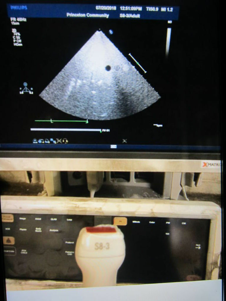 
                  
                    Philips S8-3 Probe Cardiac Sector - Adult / Fetal Probe  Transducer (53DM)
                  
                