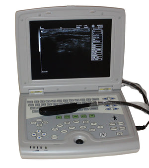 
                  
                    Veterinary Laptop Ultrasound Scanner 10" LCD & Rectal Probe - USA Warranty Deal
                  
                