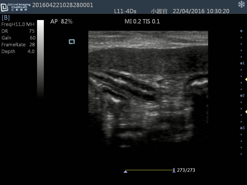 
                  
                    New Generation Laptop Veterinary Ultrasound 15" Screen & Rectal Probe, Keebomed
                  
                