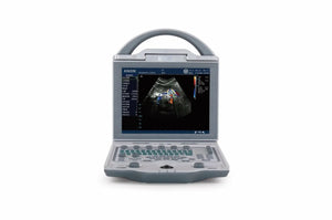 
                  
                    Affordable Color Doppler Ultrasound with 2 probes , Multi Language & PW Mode
                  
                