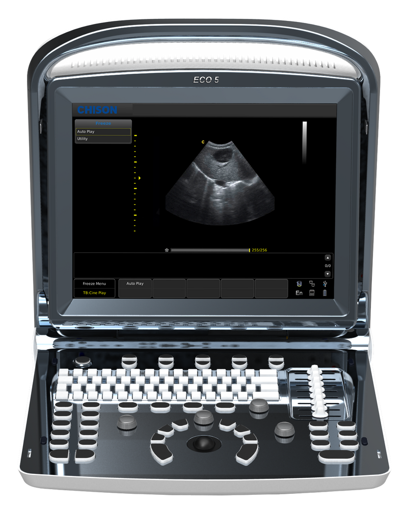 
                  
                    Chison ECO5 Color Doppler Ultrasound with One Probe
                  
                