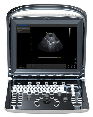 
                  
                    Chison ECO5 Color Doppler Ultrasound with One Probe
                  
                