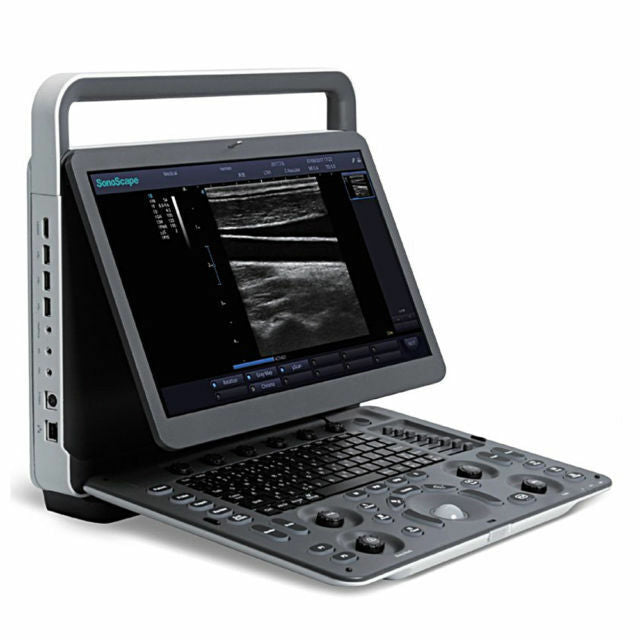 SonoScape E1 Portable Ultrasound Machine with Linear Array Probe L741