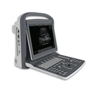 
                  
                    Chison ECO2 Powerful Affordable Lightweight 15" LED Ultrasound w/ Battery & Case
                  
                