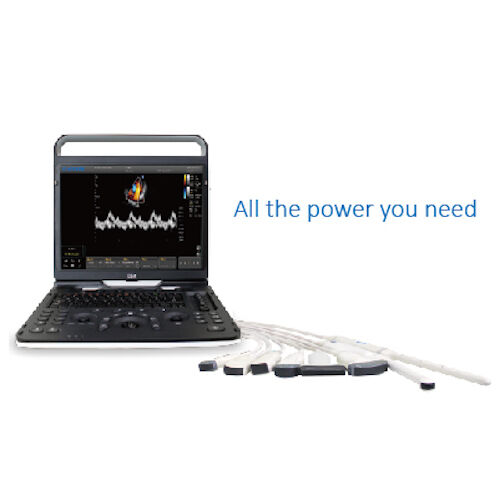 
                  
                    Chison eBit 60 Color Doppler Ultrasound Scanner CW w/ Cardiac and Linear Probes
                  
                