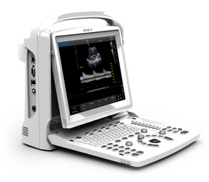 
                  
                    Great Value B&W Diagnostic Ultrasound Machine, Chison ECO3 With One Probe
                  
                